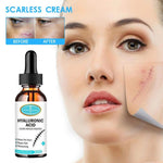 Reparación Cicatrices - Ácido Hialurónico ⭐⭐⭐⭐⭐