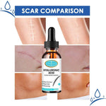 Reparación Cicatrices - Ácido Hialurónico ⭐⭐⭐⭐⭐